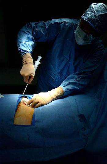 chirurg, provádění, chirurgická operace, trpěliví, tělo, úkon, nemocnice, doktor, lékař, medicína, lékařský
