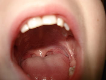 person's open mouth, Teeth, Mouth, Tongue, Lips, Cute, Head, sweet, young, male, cheek